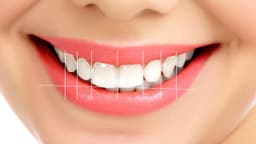Gülüş Tasarımı Nedir? Estetik Gülüşe Nasıl Sahip Olunur?