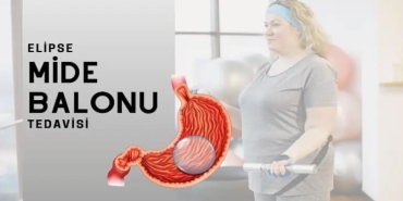 Mide Balonu Nedir?